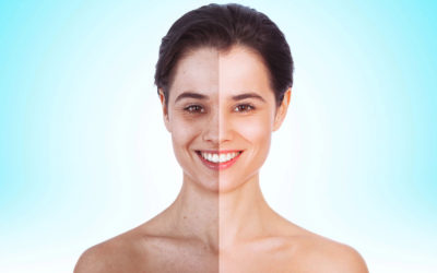 Getty bans images photoshopped to make models look thinner