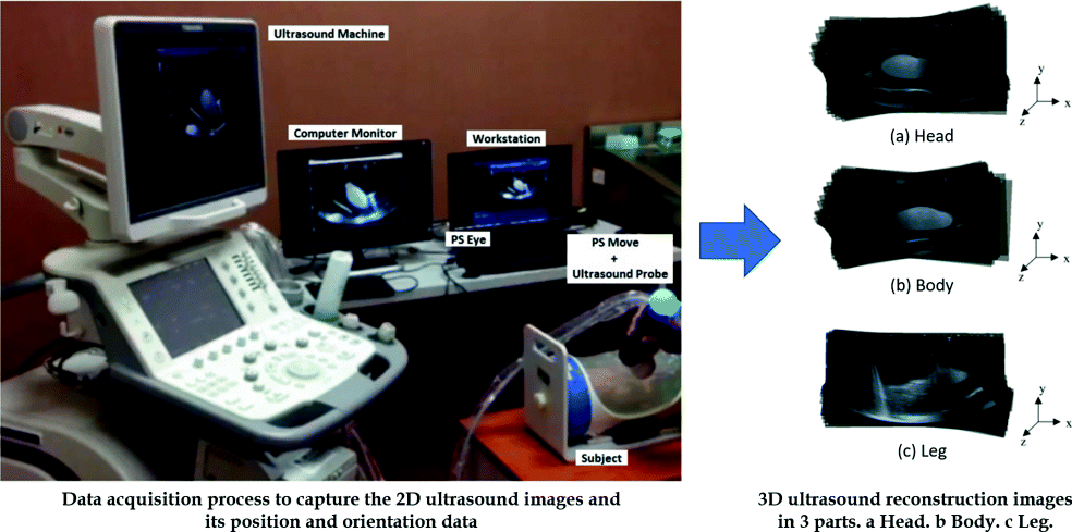 Beyond games application: Using game controller as position tracking sensor for 3D freehand ultrasound imaging